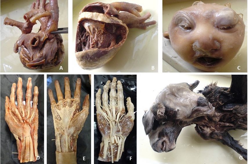 Figure 2 A, B Cadaveric specimens of the heart and D, E. hands C. Acrania in a teratologic specimen G. Head duplication in an lamp